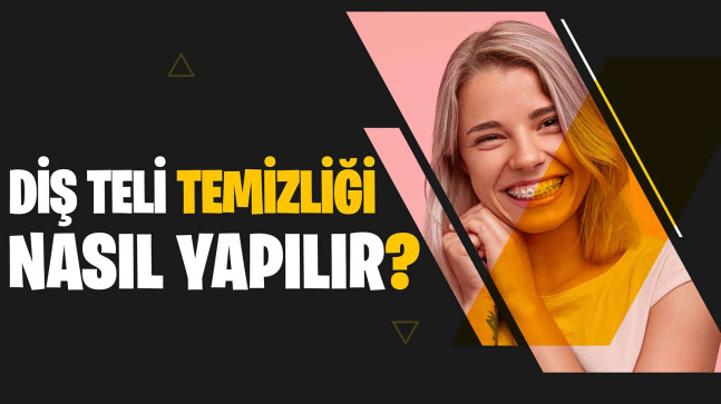 Diş Teli Temizliği Nasıl Yapılmalıdır?
